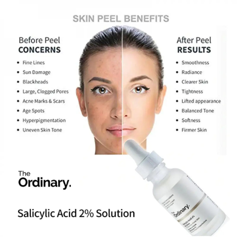 The Ordinary - Niacinamide 10% + Zinc 1% (30ml)